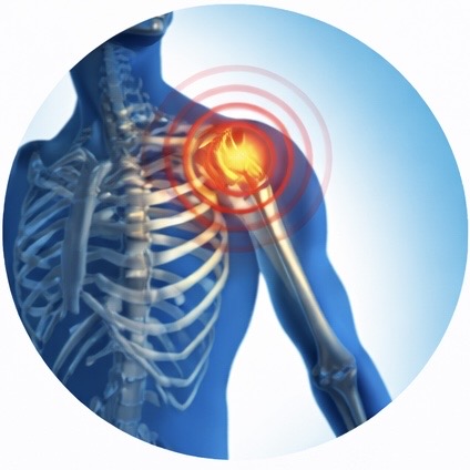 Shoulder Pain